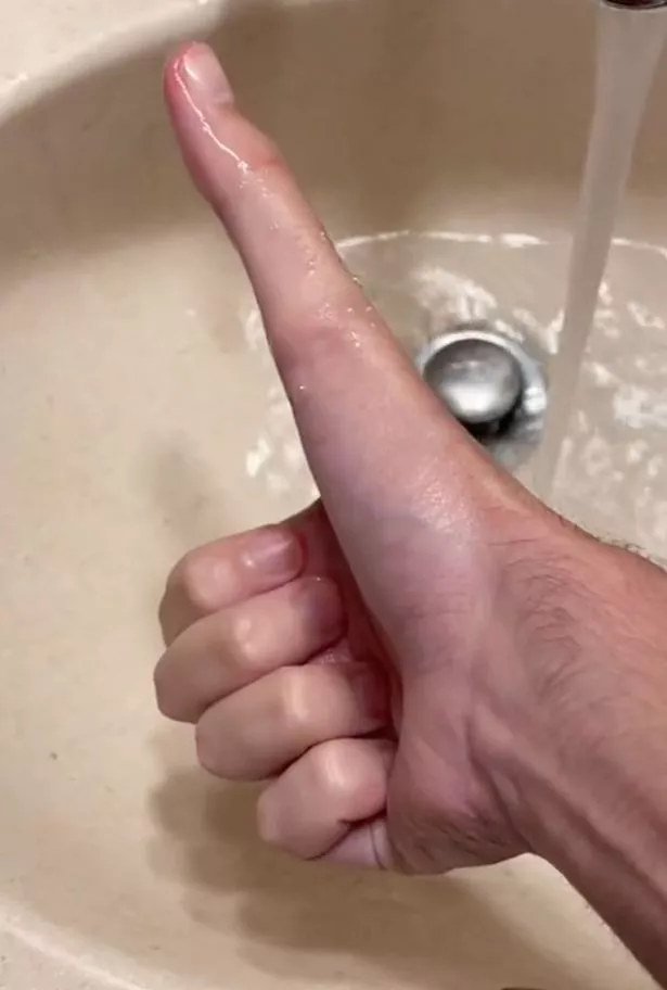 Чрезвычайно длинный большой палец